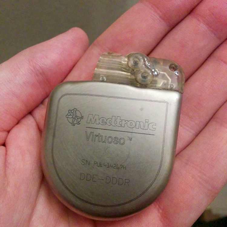 photo of pacemaker in my hand